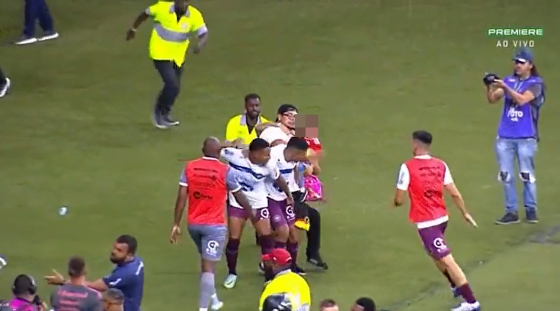 FOTO: Jogador do Caxias fica com nariz 'deformado' após confusão em jogo  contra o Inter