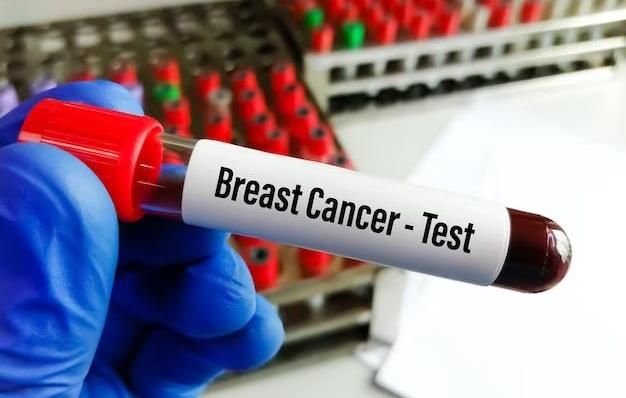 Exame de sangue em teste identifica mais de 50 tipos de câncer - Oeste Mais